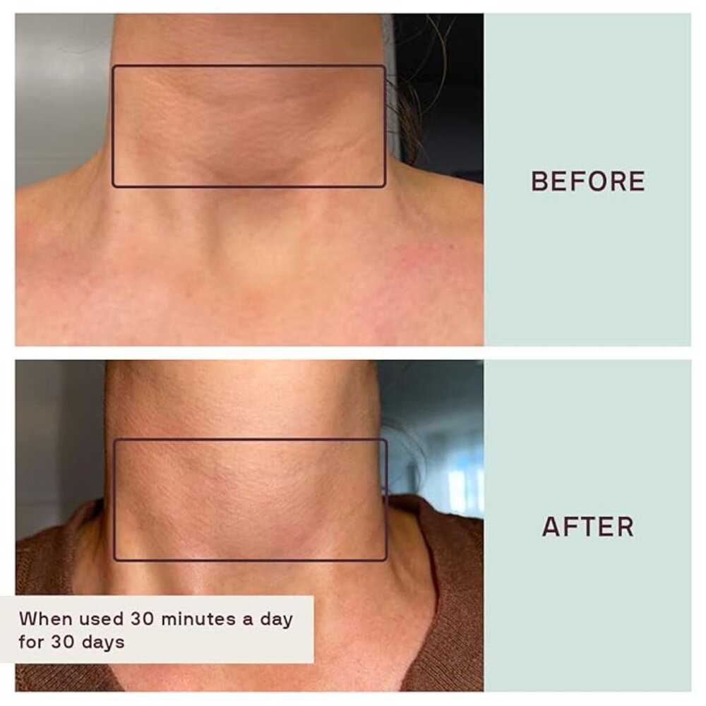 Dermaclara Neck Patch - Picture 5 of 5